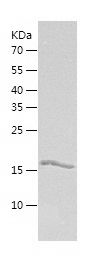    Ube2G1 / Recombinant Human Ube2G1