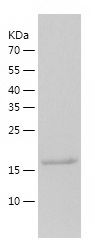    Ube2H / Recombinant Human Ube2H