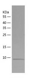    SNRPF / Recombinant Human SNRPF