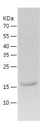    CNBP / Recombinant Human CNBP