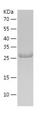    RPS4X / Recombinant Human RPS4X