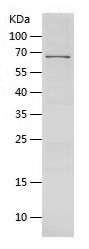    alpha smooth muscle Actin / Recombinant Human alpha smooth muscle Actin