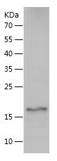    UBC4 / Recombinant Human UBC4