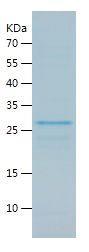 Recombinant Mouse eIF4E