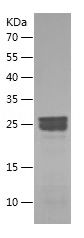 Recombinant Rat HMGB1