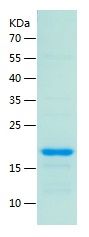    Sumo 1 / Recombinant Human Sumo 1