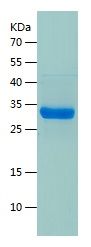    RACK1 / Recombinant Human RACK1