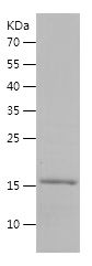    Hemoglobin subunit gamma-1 / Recombinant Human Hemoglobin subunit gamma-1