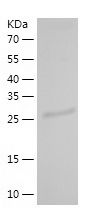    RPP30 / Recombinant Human RPP30