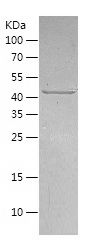    Casein Kinase 1 gamma 2 / Recombinant Human Casein Kinase 1 gamma 2