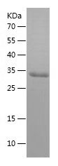    PRAME / Recombinant Human PRAME