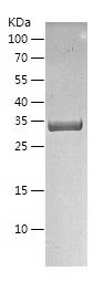    NTH1 / Recombinant Human NTH1