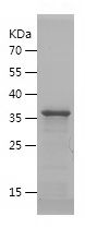    DCD / Recombinant Human DCD