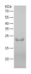    CBX1 / Recombinant Human CBX1