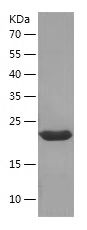 Recombinant Human