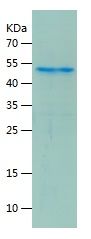    TSG6 / Recombinant Human TSG6