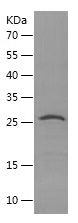    mtTFA / Recombinant Human mtTFA