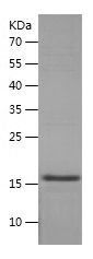    MDM2 / Recombinant Human MDM2