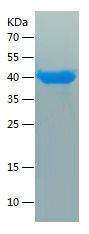    SET / Recombinant Human SET