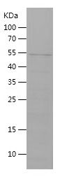    MEF2A / Recombinant Human MEF2A