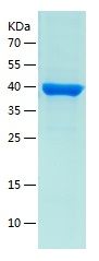    DHODH / Recombinant Human DHODH