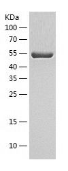    ALDH6A1 / Recombinant Human ALDH6A1