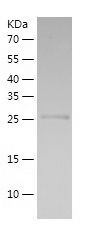    Hex / Recombinant Human Hex