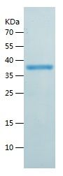    AKR1C1 / Recombinant Human AKR1C1