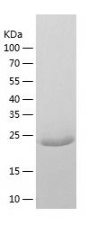    FVT1 / Recombinant Human FVT1