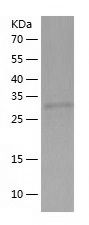    Rad51 / Recombinant Human Rad51