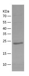    GC1q R / Recombinant Human GC1q R