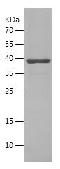    MCL1 / Recombinant Human MCL1