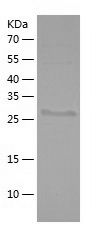    ACTN3 / Recombinant Human ACTN3