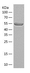    Calcineurin A / Recombinant Human Calcineurin A