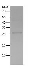    TWF1 / Recombinant Human TWF1