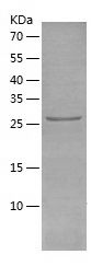    DEP1 / Recombinant Human DEP1