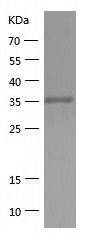    ELAVL2 / Recombinant Human ELAVL2