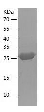    ECH1 / Recombinant Human ECH1