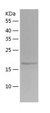    RIZ1 / Recombinant Human RIZ1