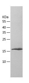    Miz1 / Recombinant Human Miz1