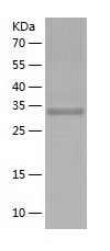    N myc interactor / Recombinant Human N myc interactor