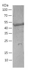    FKBP51 / Recombinant Human FKBP51