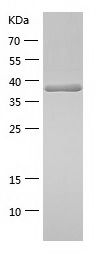    SQSTM1 / Recombinant Human SQSTM1