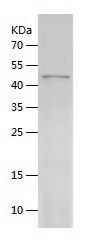    beta III Tubulin / Recombinant Human beta III Tubulin