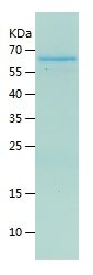    ASAH1 / Recombinant Human ASAH1