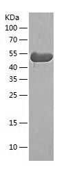    CaMKII beta / Recombinant Human CaMKII beta