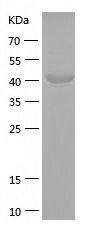    p50 dynamitin / Recombinant Human p50 dynamitin