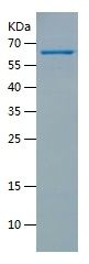    APPBP1 / Recombinant Human APPBP1