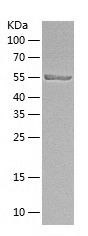    IRF5 / Recombinant Human IRF5