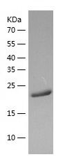    RAB32 / Recombinant Human RAB32